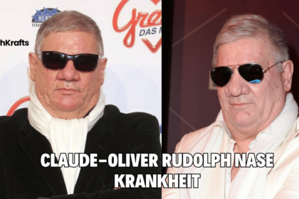 Claude-oliver Rudolph Nase Krankheit